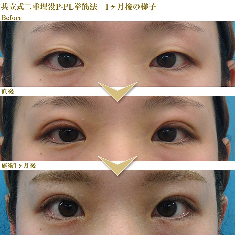 症例