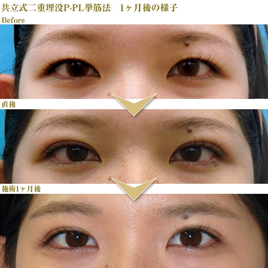 症例