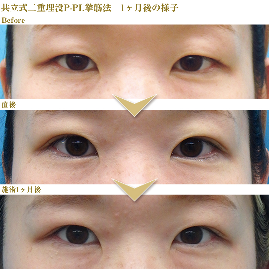 症例