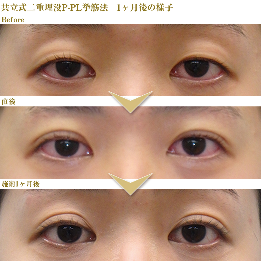 症例