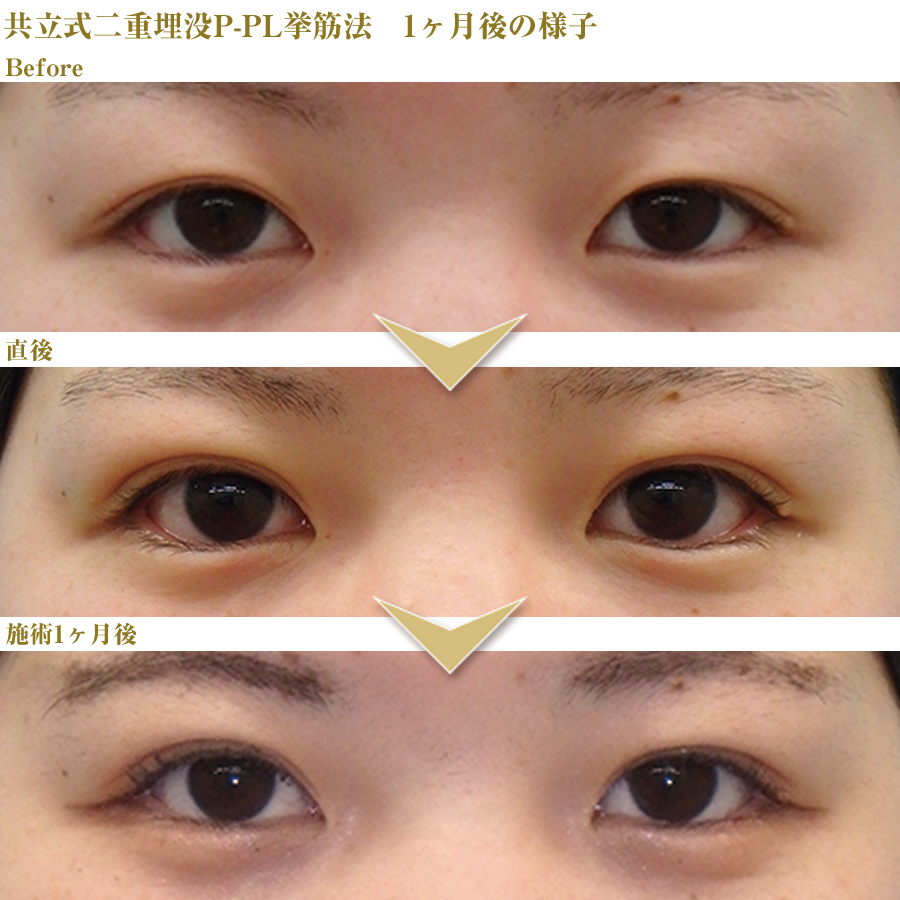 症例