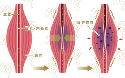 肩こりボトックス図