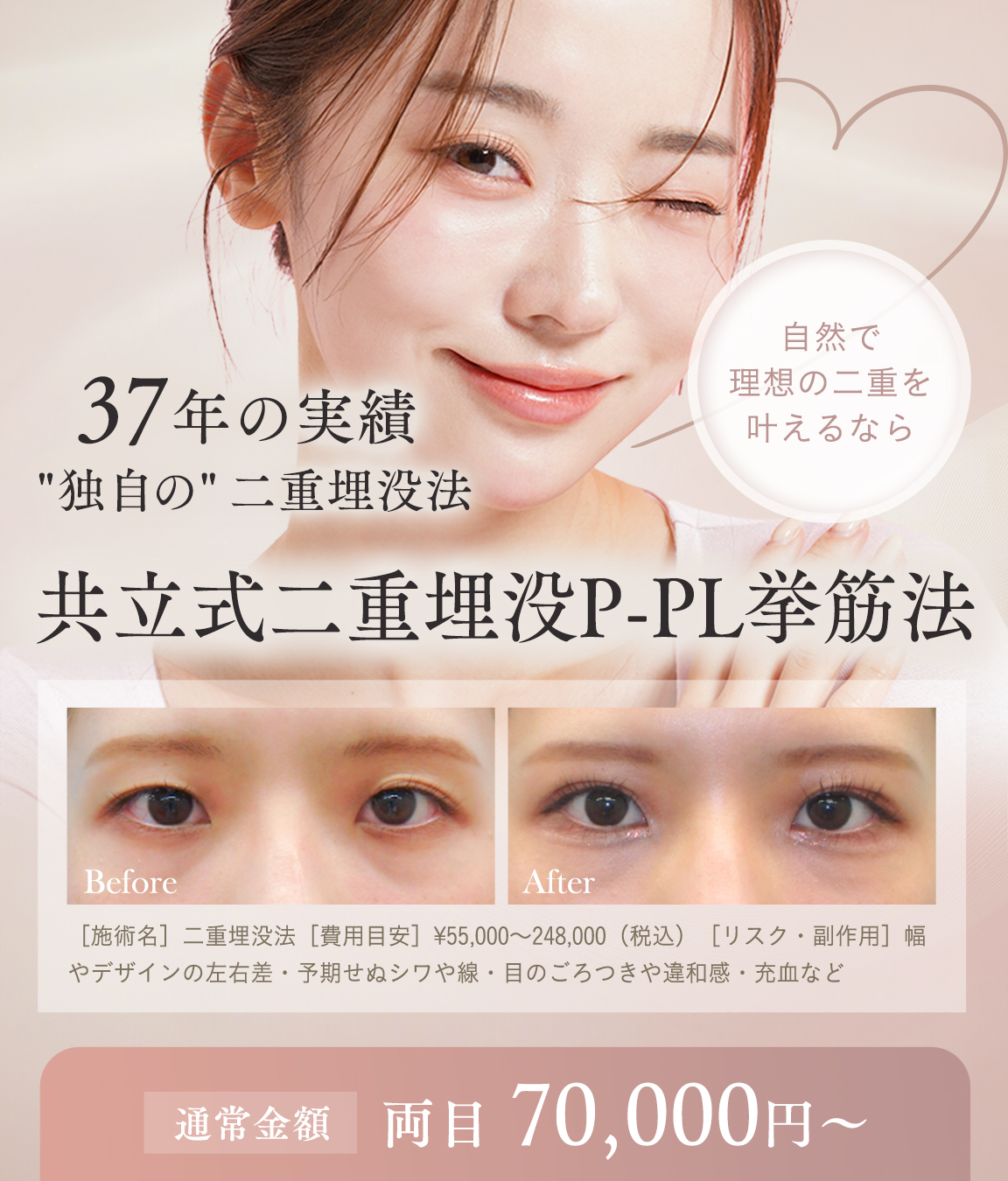 オーダーメイド二重 「共立式二重埋没P-PL挙筋法」