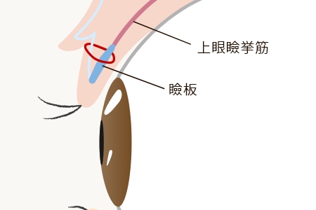 挙筋法
