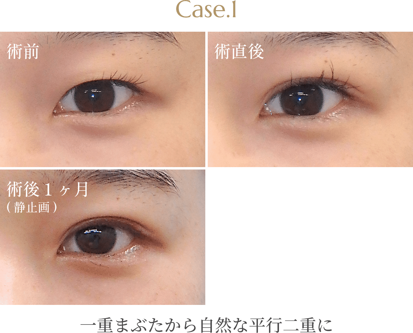 Case.1