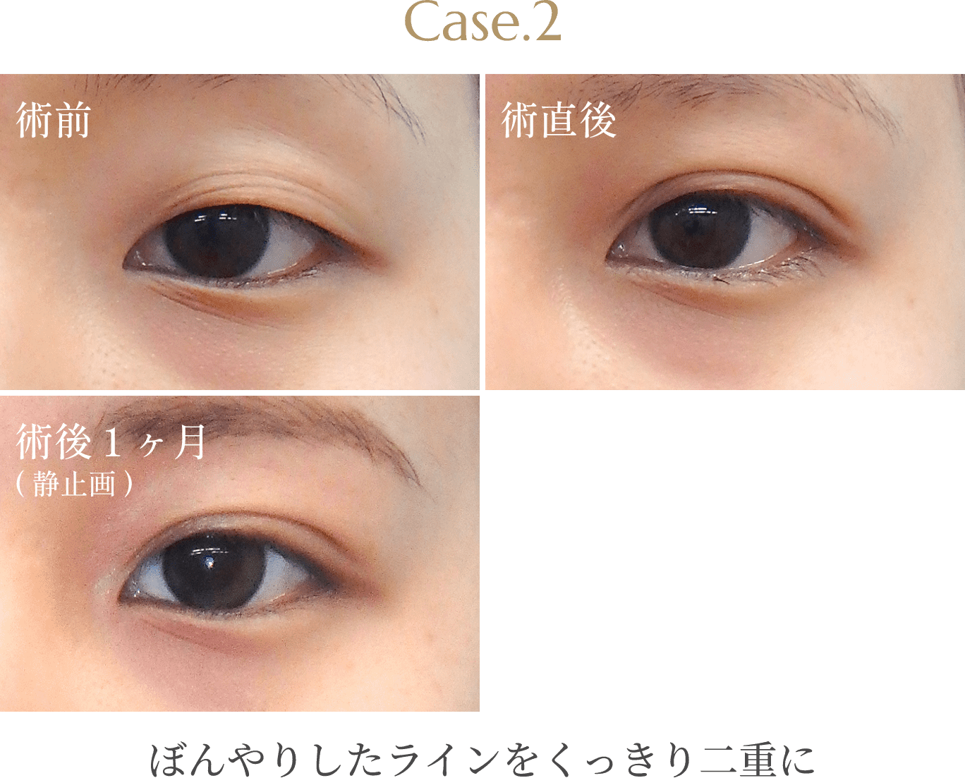 Case.2
