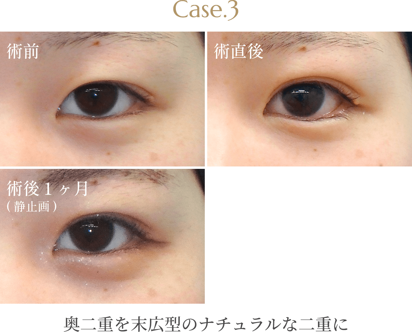 Case.3