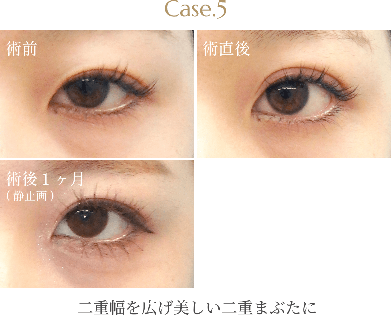Case.5