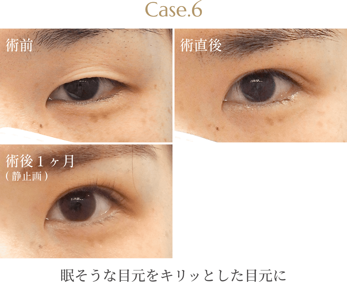 Case.6